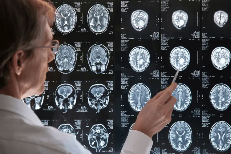 traumatic-brain-injury